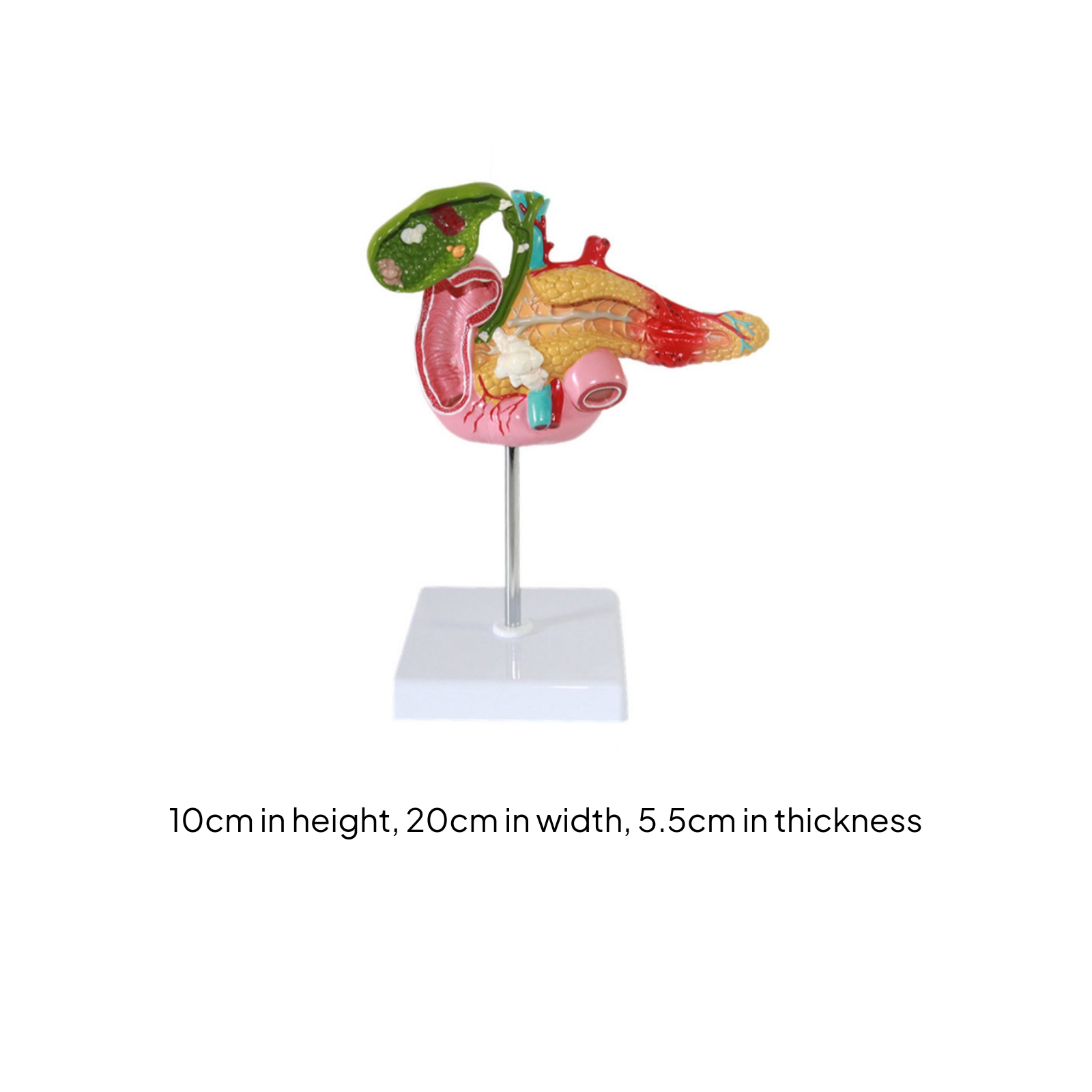 Pancreas Pathology Model Gallstones Mounted Anatomy Display White Base