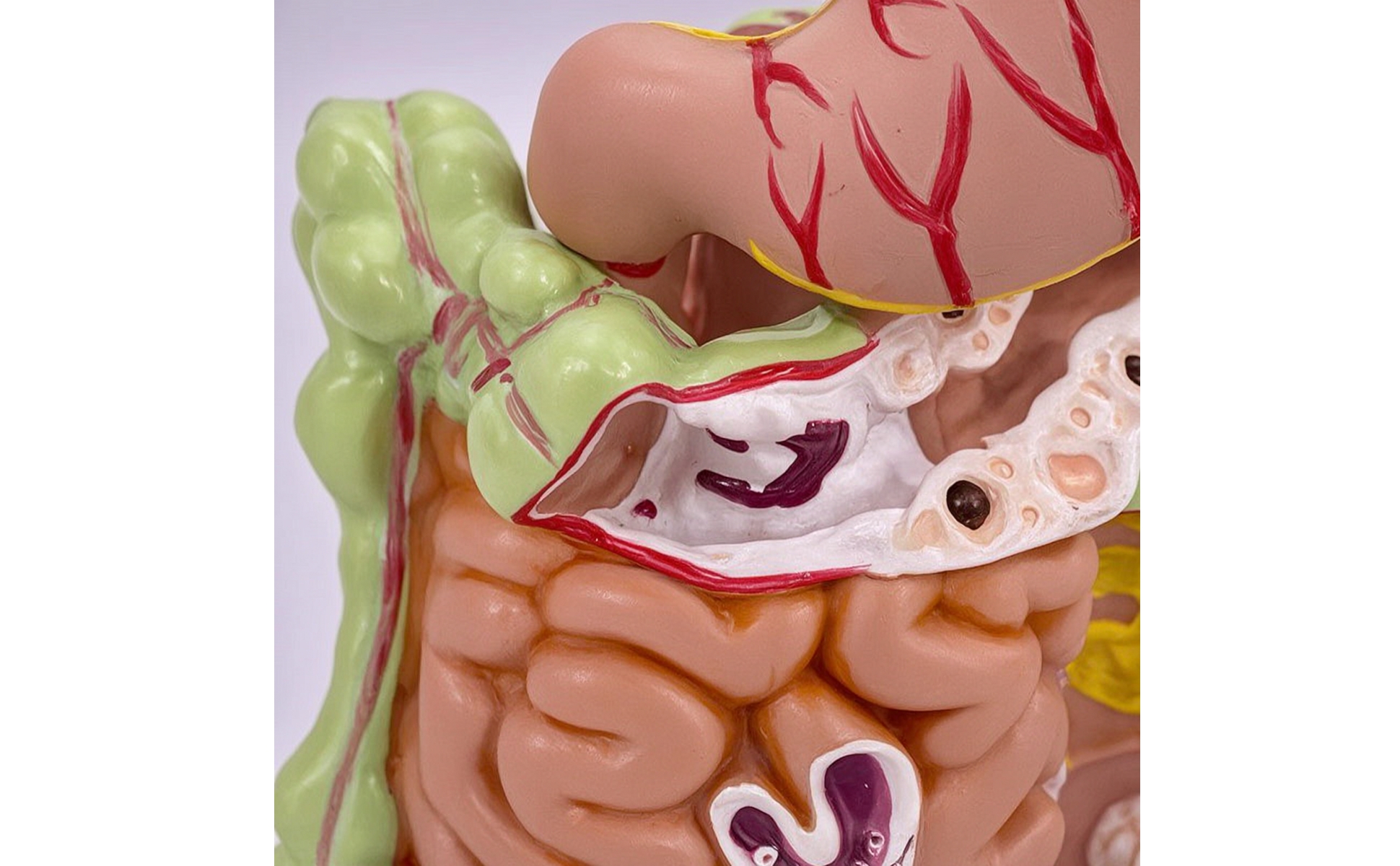 Large Intestine Model with Stomach Pathology for Classroom, Doctors, Teachers