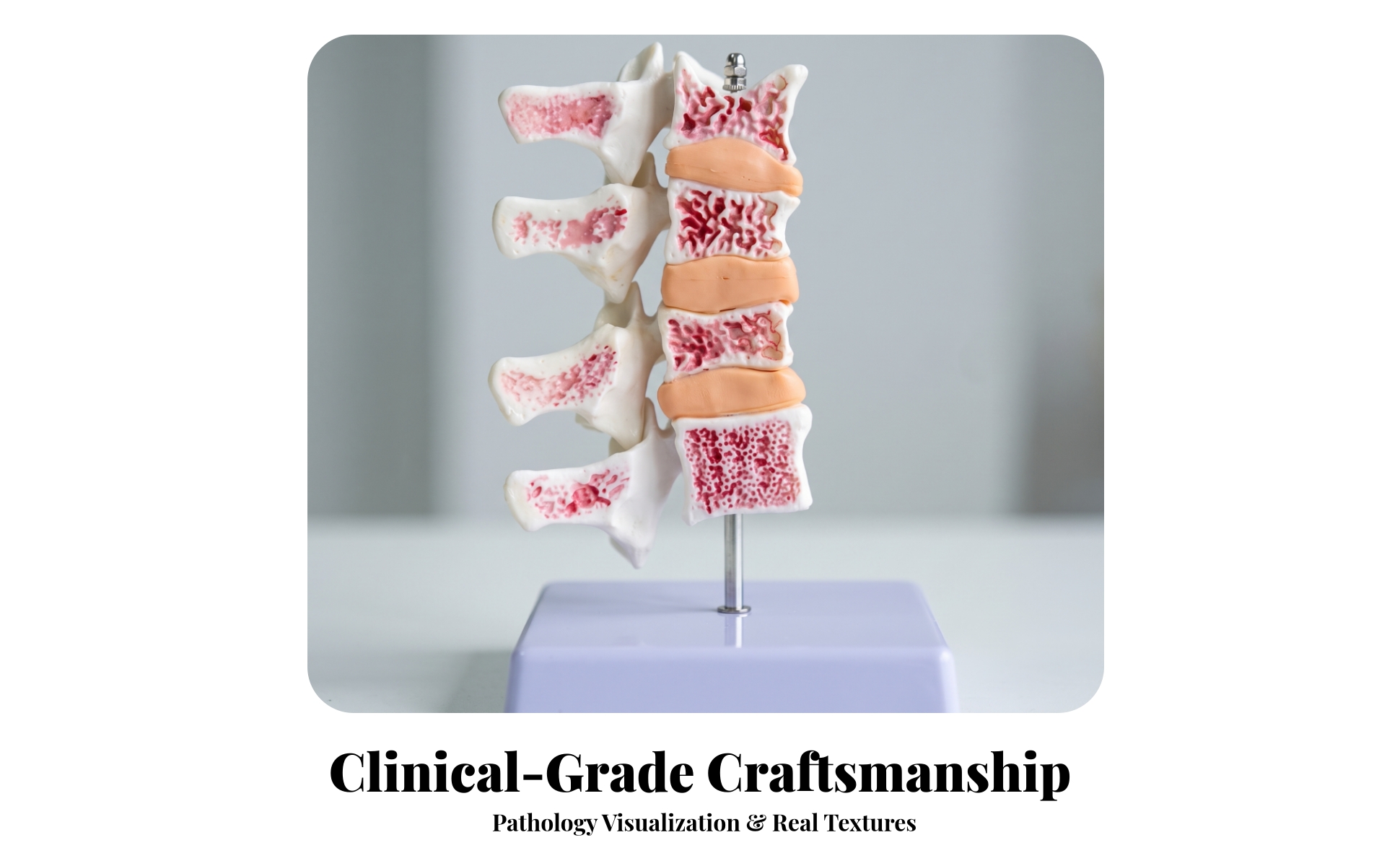 Osteoporosis Spine Model Stable for Classroom, Laboratory, Doctors, Teachers