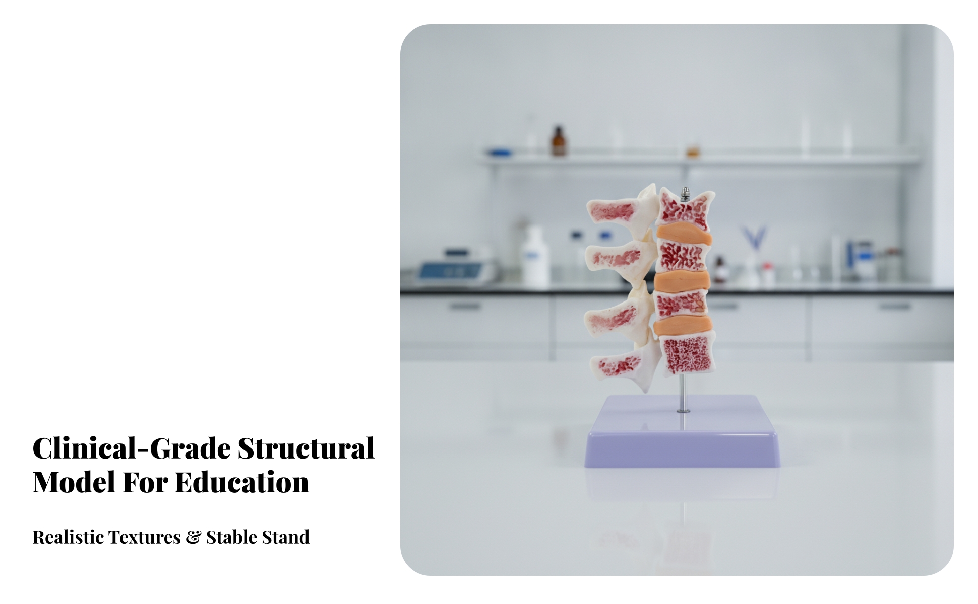 Osteoporosis Spine Model Stable for Classroom, Laboratory, Doctors, Teachers