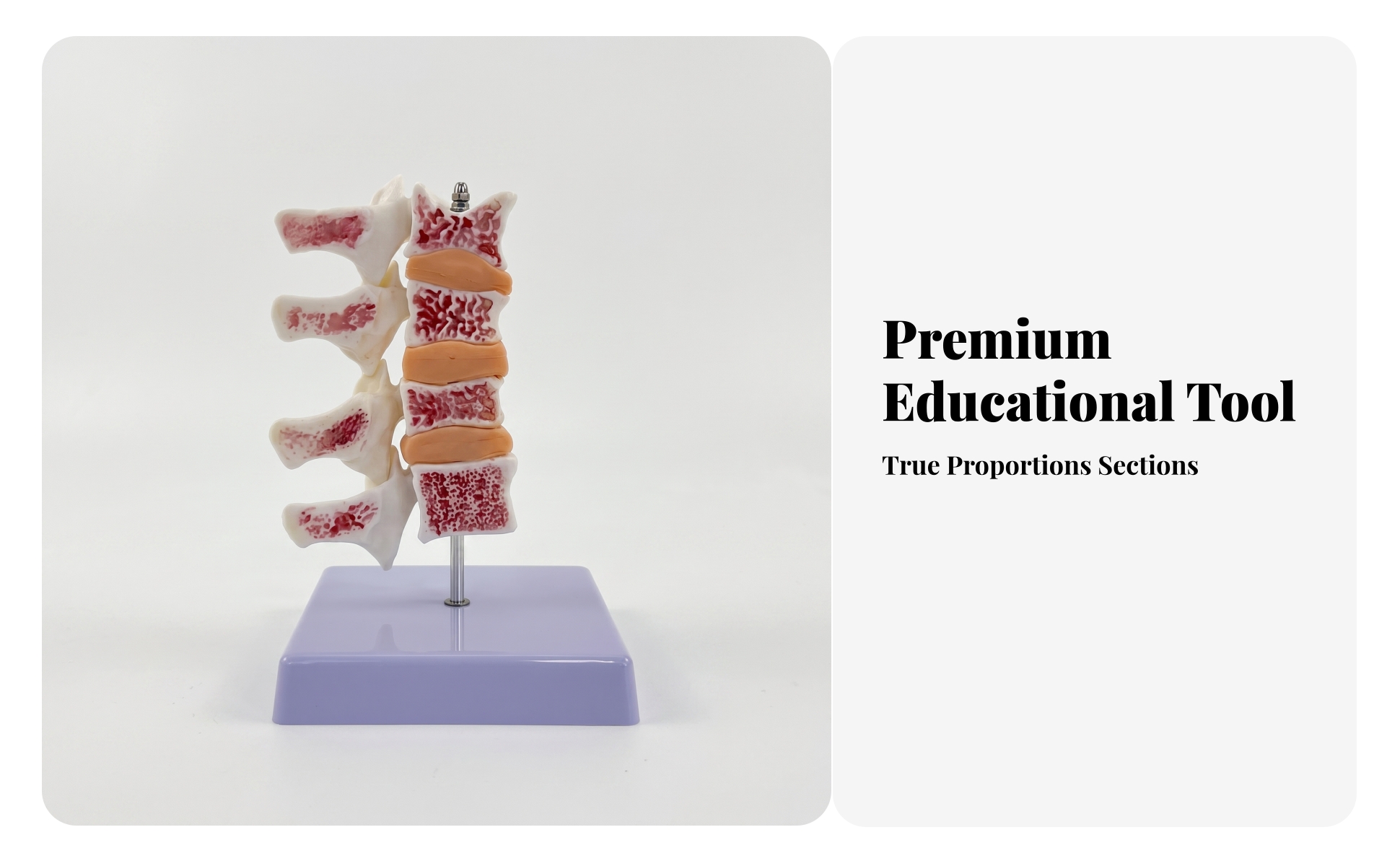 Osteoporosis Spine Model Stable for Classroom, Laboratory, Doctors, Teachers